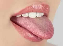 dark-spots-on-your-tongue