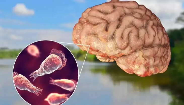 minister veena george, amebic meningoencephalitis