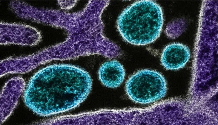chandipura-virus